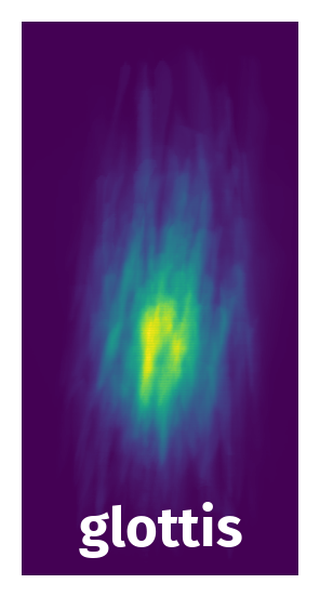 Spatial Heatmap