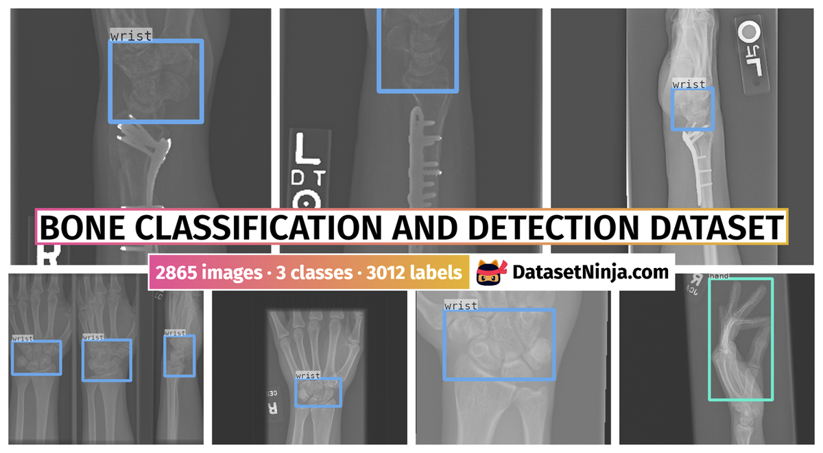 Dataset Poster