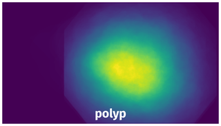 Spatial Heatmap