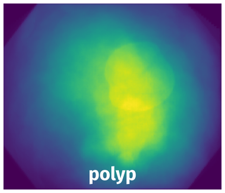 Spatial Heatmap