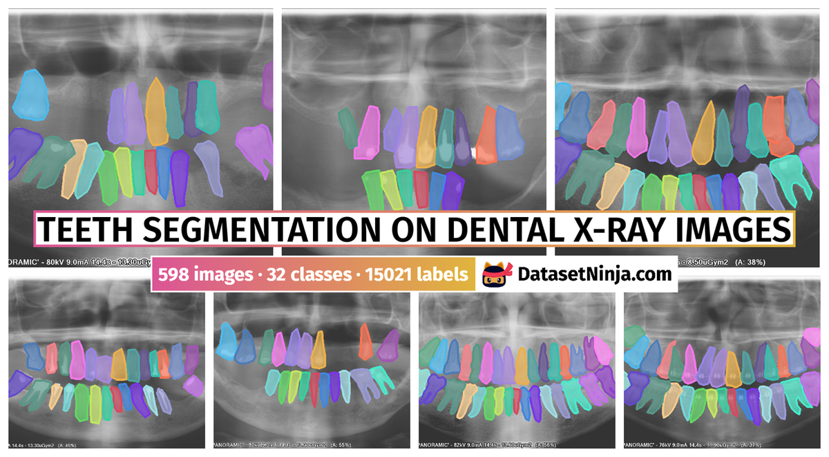 Dataset Poster