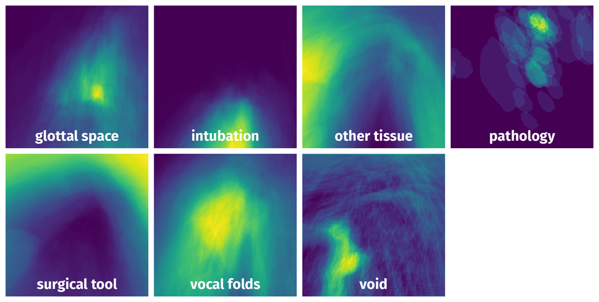 Spatial Heatmap