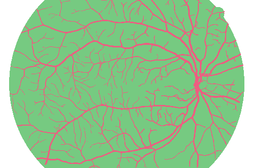 Sample annotation mask from High Resolution Fundus