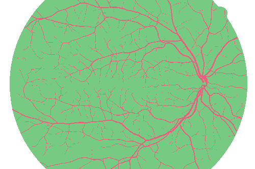 Sample annotation mask from High Resolution Fundus