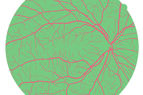 Sample annotation mask from High Resolution Fundus