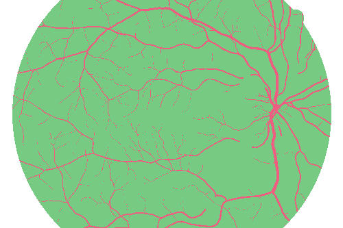 Sample annotation mask from High Resolution Fundus