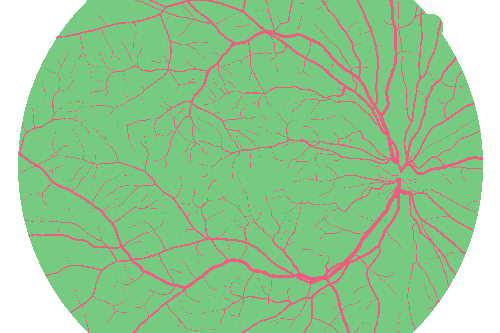 Sample annotation mask from High Resolution Fundus