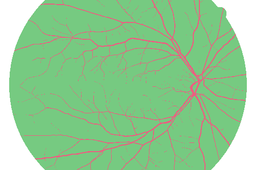 Sample annotation mask from High Resolution Fundus