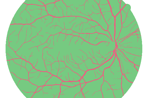 Sample annotation mask from High Resolution Fundus