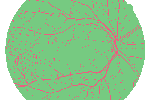 Sample annotation mask from High Resolution Fundus