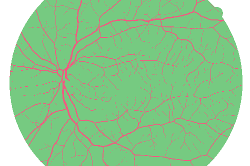 Sample annotation mask from High Resolution Fundus