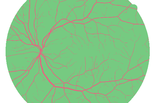 Sample annotation mask from High Resolution Fundus