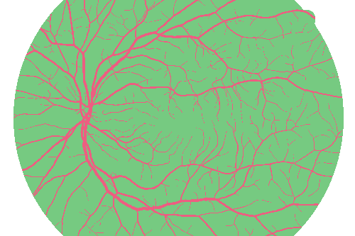 Sample annotation mask from High Resolution Fundus