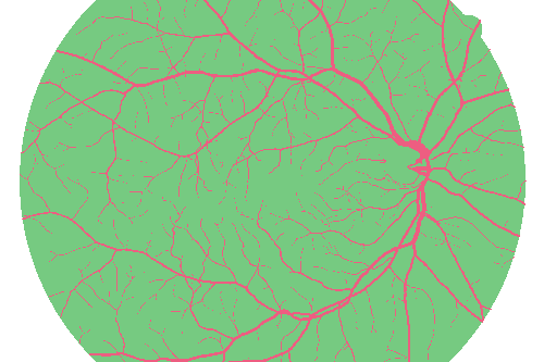 Sample annotation mask from High Resolution Fundus