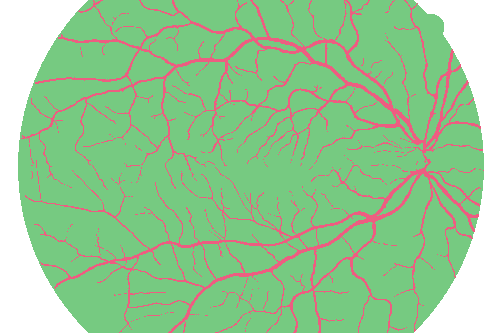 Sample annotation mask from High Resolution Fundus