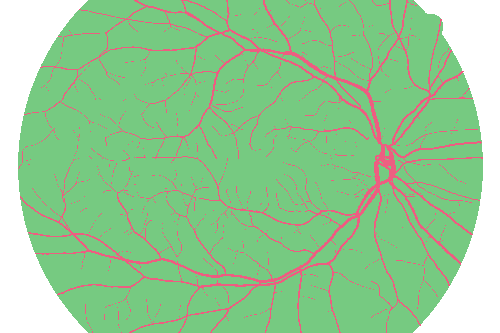 Sample annotation mask from High Resolution Fundus