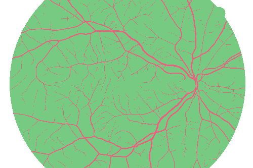 Sample annotation mask from High Resolution Fundus