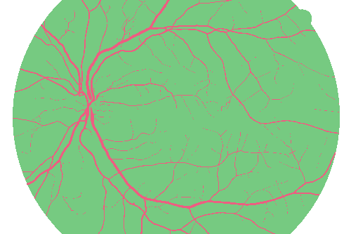Sample annotation mask from High Resolution Fundus
