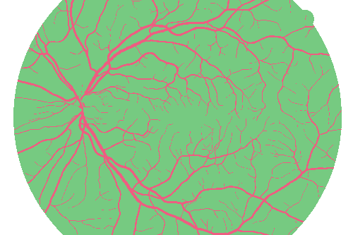 Sample annotation mask from High Resolution Fundus