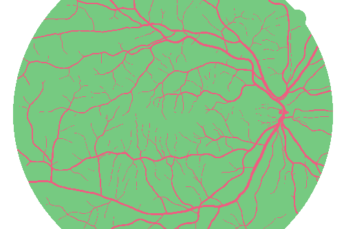 Sample annotation mask from High Resolution Fundus