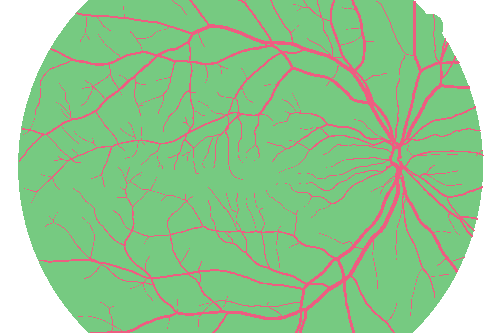 Sample annotation mask from High Resolution Fundus