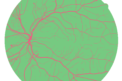 Sample annotation mask from High Resolution Fundus