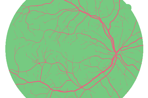 Sample annotation mask from High Resolution Fundus