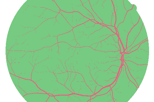 Sample annotation mask from High Resolution Fundus