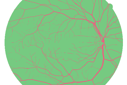 Sample annotation mask from High Resolution Fundus