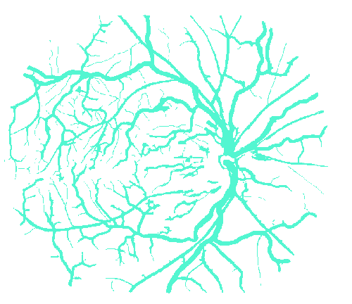 Sample annotation mask from STARE