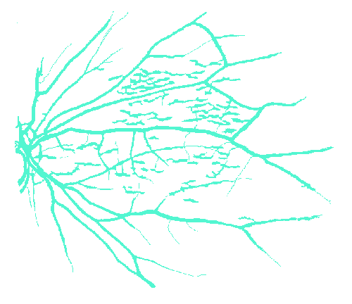 Sample annotation mask from STARE