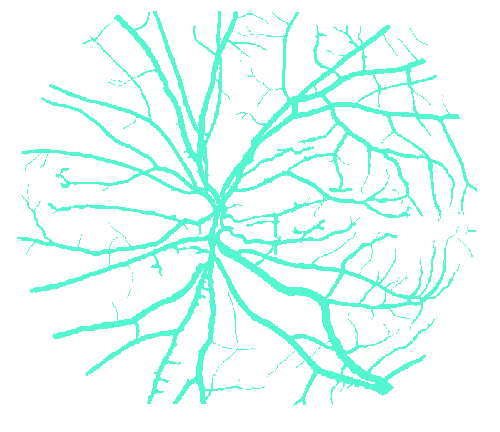 Sample annotation mask from STARE