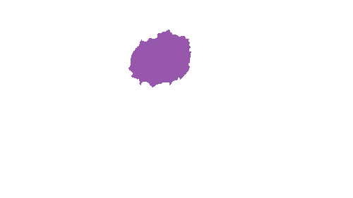 Sample annotation mask from Accurate Nevus Shapes