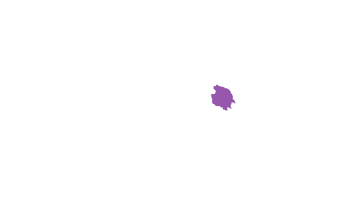 Sample annotation mask from Accurate Nevus Shapes