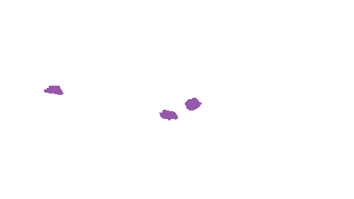 Sample annotation mask from Accurate Nevus Shapes