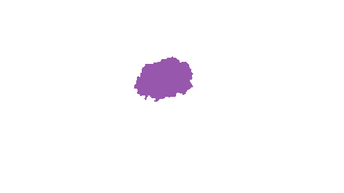 Sample annotation mask from Accurate Nevus Shapes