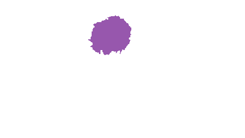 Sample annotation mask from Accurate Nevus Shapes