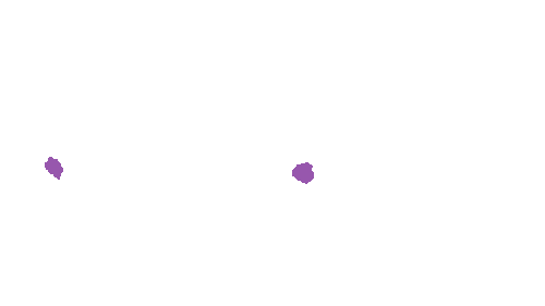 Sample annotation mask from Accurate Nevus Shapes