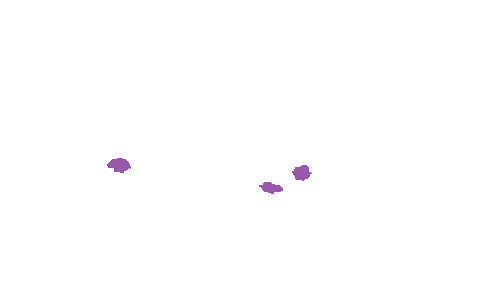 Sample annotation mask from Accurate Nevus Shapes