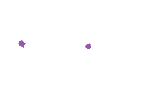 Sample annotation mask from Accurate Nevus Shapes