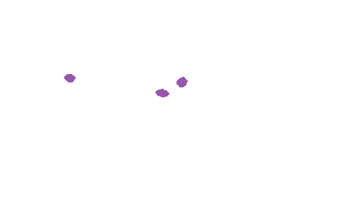 Sample annotation mask from Accurate Nevus Shapes