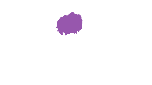 Sample annotation mask from Accurate Nevus Shapes