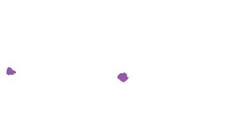 Sample annotation mask from Accurate Nevus Shapes