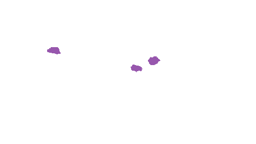 Sample annotation mask from Accurate Nevus Shapes