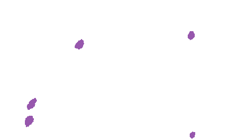 Sample annotation mask from Accurate Nevus Shapes