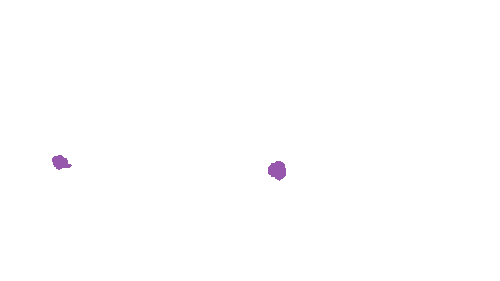 Sample annotation mask from Accurate Nevus Shapes