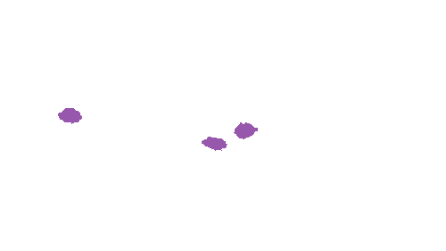 Sample annotation mask from Accurate Nevus Shapes