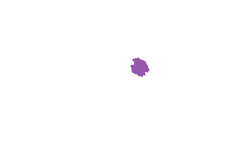 Sample annotation mask from Accurate Nevus Shapes