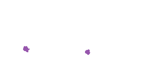 Sample annotation mask from Accurate Nevus Shapes