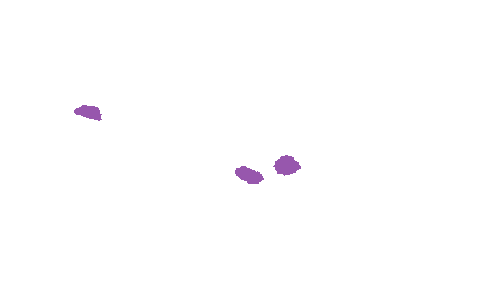 Sample annotation mask from Accurate Nevus Shapes